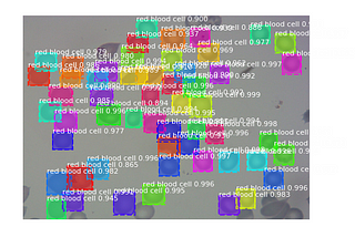 Computer Vision Techniques: Implementing Mask-R CNN on Malaria Cells Data