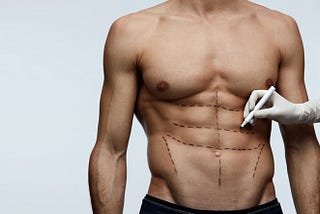 Coolsculpting Vs 6 Packs Abs Surgery