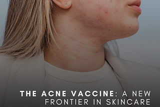 The Acne Vaccine: A New Frontier in Skincare