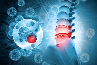 What Exactly is a Subluxation?