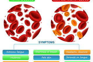 Iron Deficiency Anemia Symptoms, Causes, and Treatment