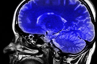 Why Traditional Goal Setting Fails for ADHD Brains (And What Actually Works)