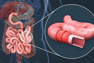 “Understanding Systemic Inflammation: Causes and Effective Strategies for Reduction”