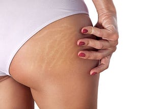 cellulite lotion