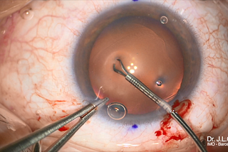 Complex Cases, Simplified (5): Reliability and confidence in complex cases.