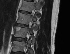Munear Ashton Kouzbari: Research: “Remarkable improvements” for spinal cord injury Veterans.