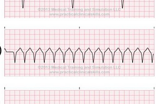 Julie Powell’s Death of “Cardiac Arrest”