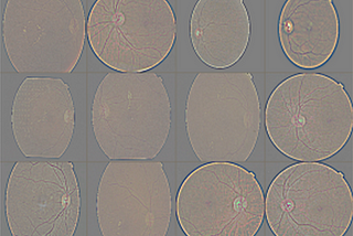 Using CNNs to Diagnose Diabetic Retinopathy