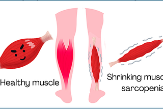 Image of a healthy leg muscle compared to a shrinking muscle of sarcopenia