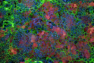 Stem cell-derived retinal pigmented epithelial cells. The cell walls are bright green, and filled with pinks and blues. Image credit: Cecile Terrenoire, PhD