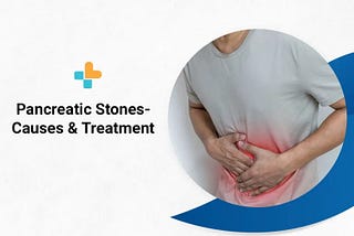 What Causes Pancreatic Stones? Symptoms and Treatments