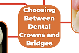 Dental crowns and bridges