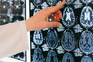 A hand pointing to one of a number of MRI brain scans on a screen. Only the hand and part of the forearm are visible. It appears that the owner of the hand is wearing a lab coat.