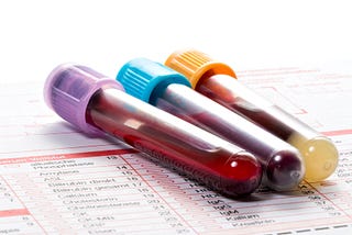 BLOOD TEST SCREENING TO DETECT EARLY-STAGE CANCER HAS BEEN DEVELOPED