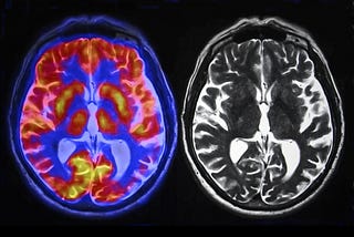 What the Studies Say About How AI Affects Your Brain: A (Very Big) Compilation