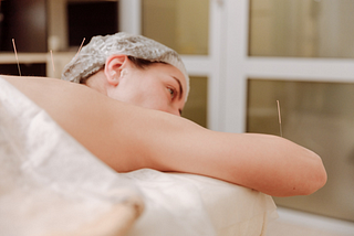 How Does Acupuncture Relieve Pain?