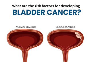 Understanding Risk Factors for Bladder Cancer | Best Urologist in Lucknow.