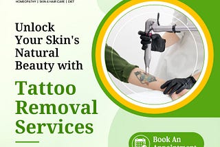 best laser tattoo removal in baner