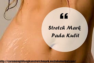 Cara menghilangkan Stretchmark paling Ampuh