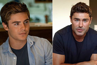 Zac Efron’s New Face — Beverly Hills Plastic Surgeon Weighs In