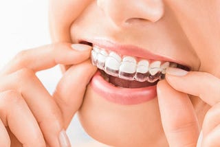Global Clear-Aligner Treatment Market Covers Top key Players- Align Technology, ClearCorrect…
