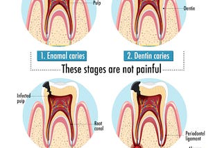 The Aetiology, prognosis, Diagnosis and Treatment of Dental Caries.