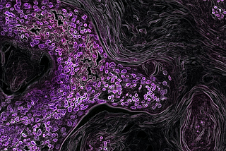 Cancer: Advice for the Newly Diagnosed