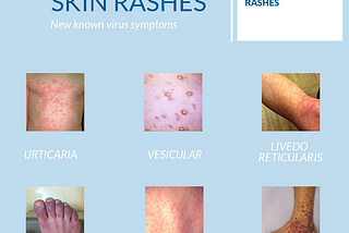 What Causes Skin Rashes on the skin? Symptoms, Treatment, and Home Remedies