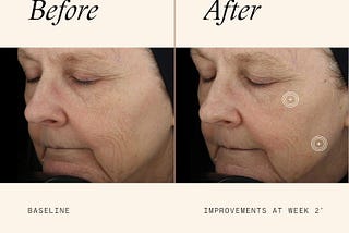 **SkinMedica TNS Advanced+ Serum**, Review .