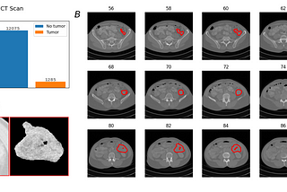 Medical images visualization with python