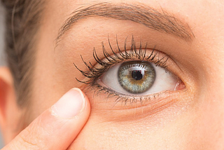 Wrinkles Under Eyes: Causes, Prevention, and Treatments for Youthful Skin
