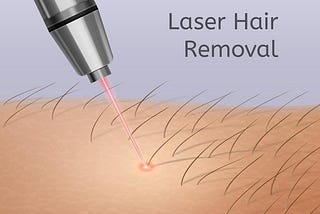 Does Laser Hair Removal Work for Beards?