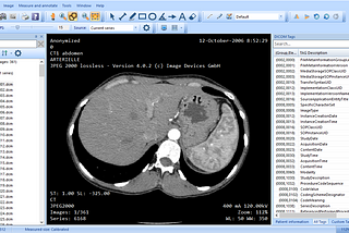 MicroDicom — A quick DICOM Viewer