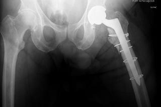 Life Is Not a Spectator Sport