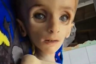 These Sweet Children of Ours Need Us