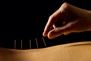 I Tried Acupuncture For 30 Days, Here’s What Happened