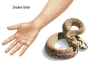 Recognizing the Symptoms of a Snake Bite