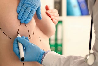 6 Things to Consider Before Getting Breast Augmentation