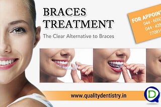 Best Braces Treatment In Chennai With Affordable Price