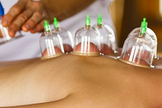 Cupping Therapy