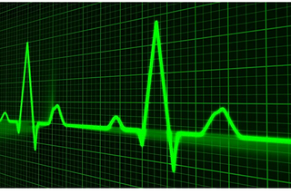 An Application of Deep Learning Model to Specify Cardiovascular Diseases via Analyzing ECG Diagrams