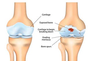10 Ways to Protect Your Knees