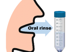 Ultrasensitive Detection of Tumour-Specific Mutations in Saliva of Patients With Oral Cavity…
