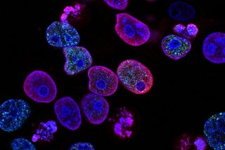 Use Case: Highlighting Blood Cells in Dark-field Microscopy Using Image Segmentation