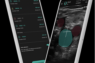 Ultrasound AI — A new paradigm