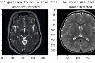 AI Enabled Brain Tumor Detection in MRI Images- CNN/EfficientNetB0 | Shoeb Ahmad