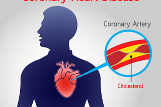 South African Coronary Heart Disease