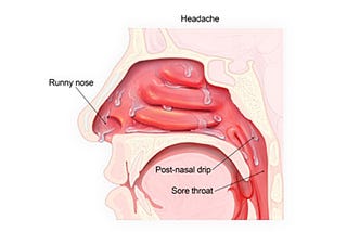 How long does the common cold last