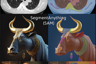 Segment Anything Model (SAM) for Medical Image Segmentation