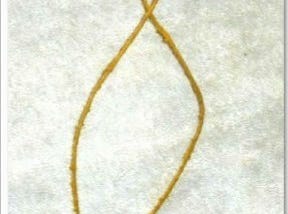 Ksharsutra